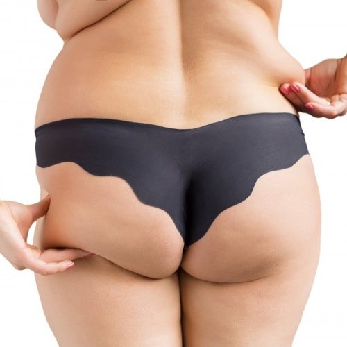 Brazilian Butt (Fat Grafting) - Dr. Andres Freschi